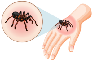 The Importance Of Preventive Pest Control 2 Spider bite